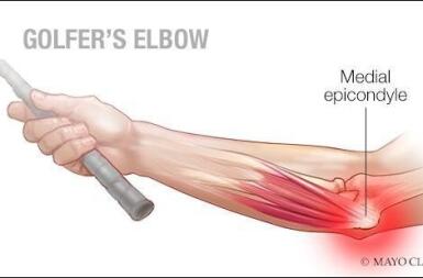 GOLF ELBOW – VIÊM LỒI CẦU TRONG: CƠN ĐAU ÂM Ỉ KHÔNG CHỈ CỦA NGƯỜI CHƠI GOLF
