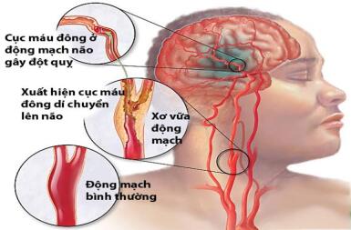 tai_bien_mach_mau_nao
