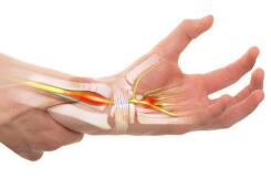 HỘI CHỨNG ỐNG CỔ TAY: KHI TÊ TAY KHÔNG CHỈ LÀ CHUYỆN NHỎ