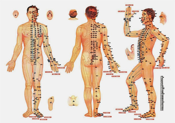 A doctor performing acupuncture on a patient